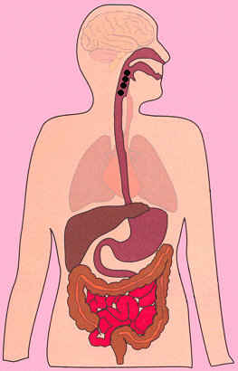 有了青海东大磁控胶囊胃镜，再也不担心做胃镜了