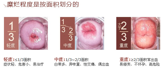 许周-Kevin老师女性健康问题专访：原来女性子宫保养这么关键。(图2)